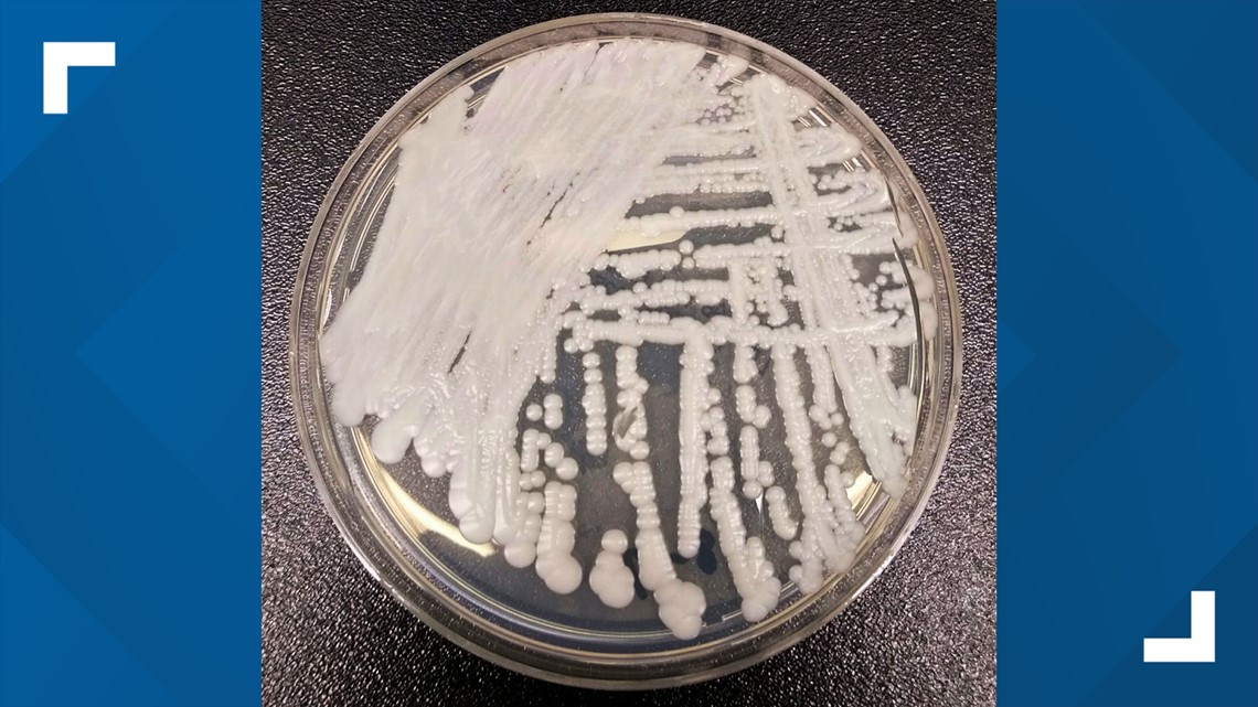 Candida auris: Drug-resistant fungus spreading in US, CDC says 