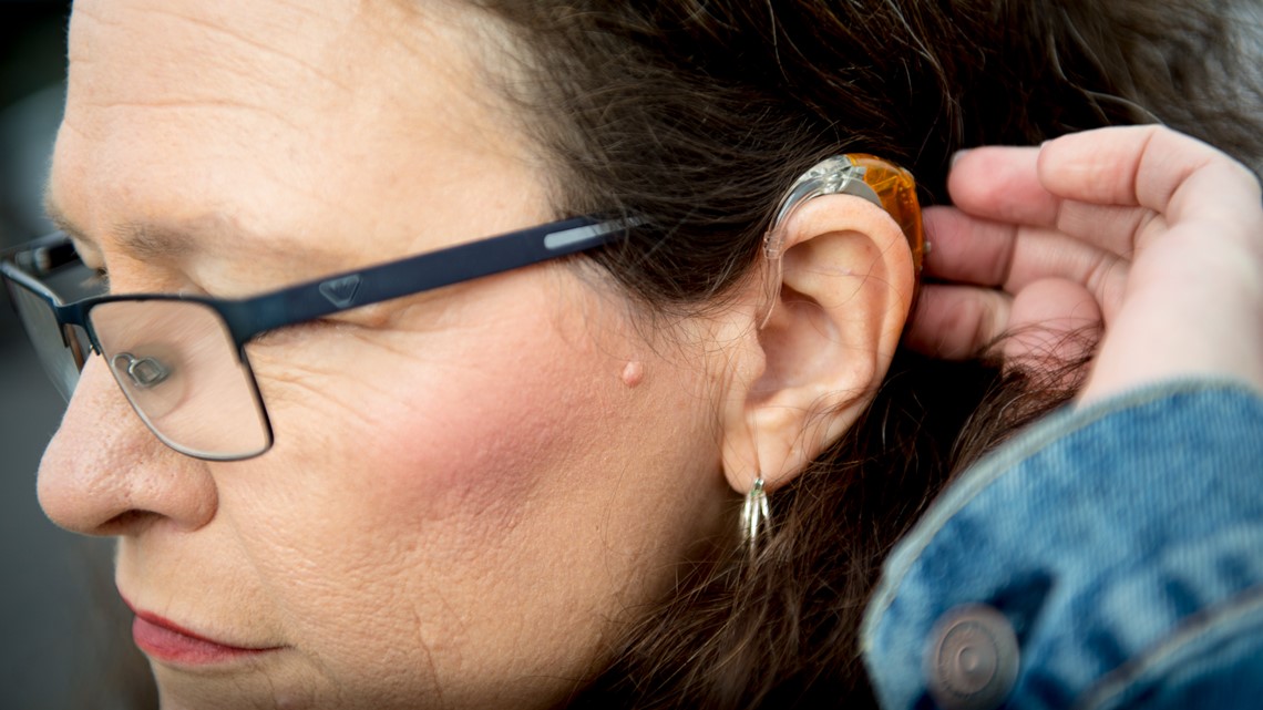 FDA proposes hearing aids over-the-counter to cut costs - Vimarsana News