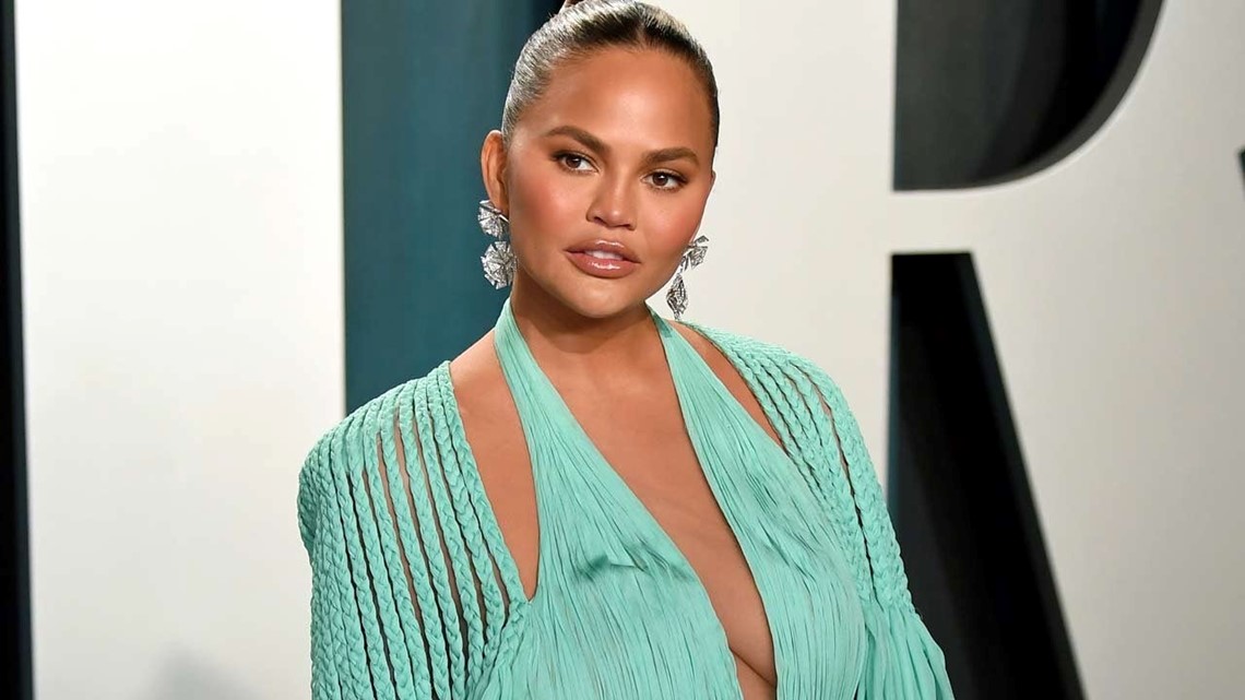 Chrissy Teigen Reveals She Had Plastic Surgery at Age 20: 'I Did