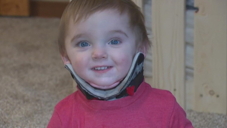 Texas 1-year-old survives freak accident that caused six skull fractures