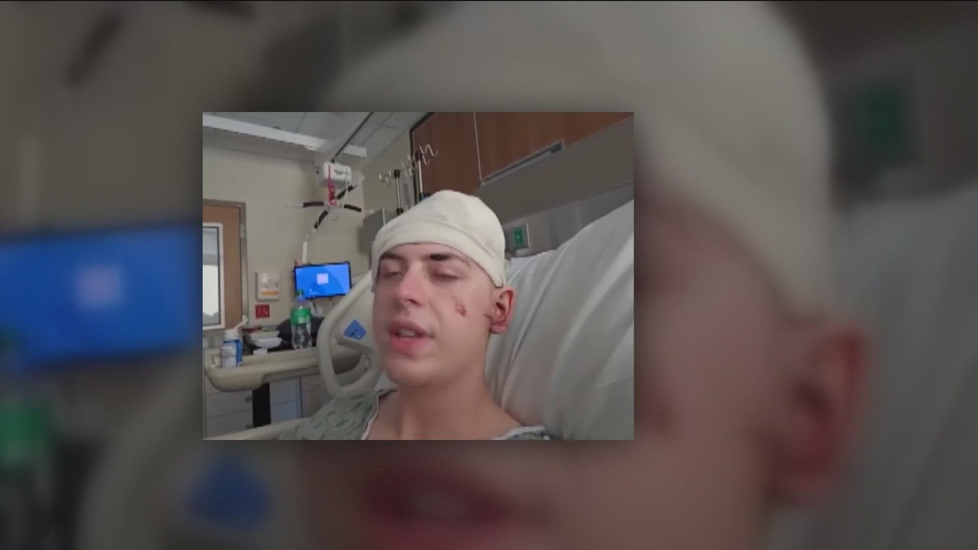 Seth Gott, 19, was attacked by a stranger with a machete on Tuesday near Auditorium Shores in Downtown Austin.