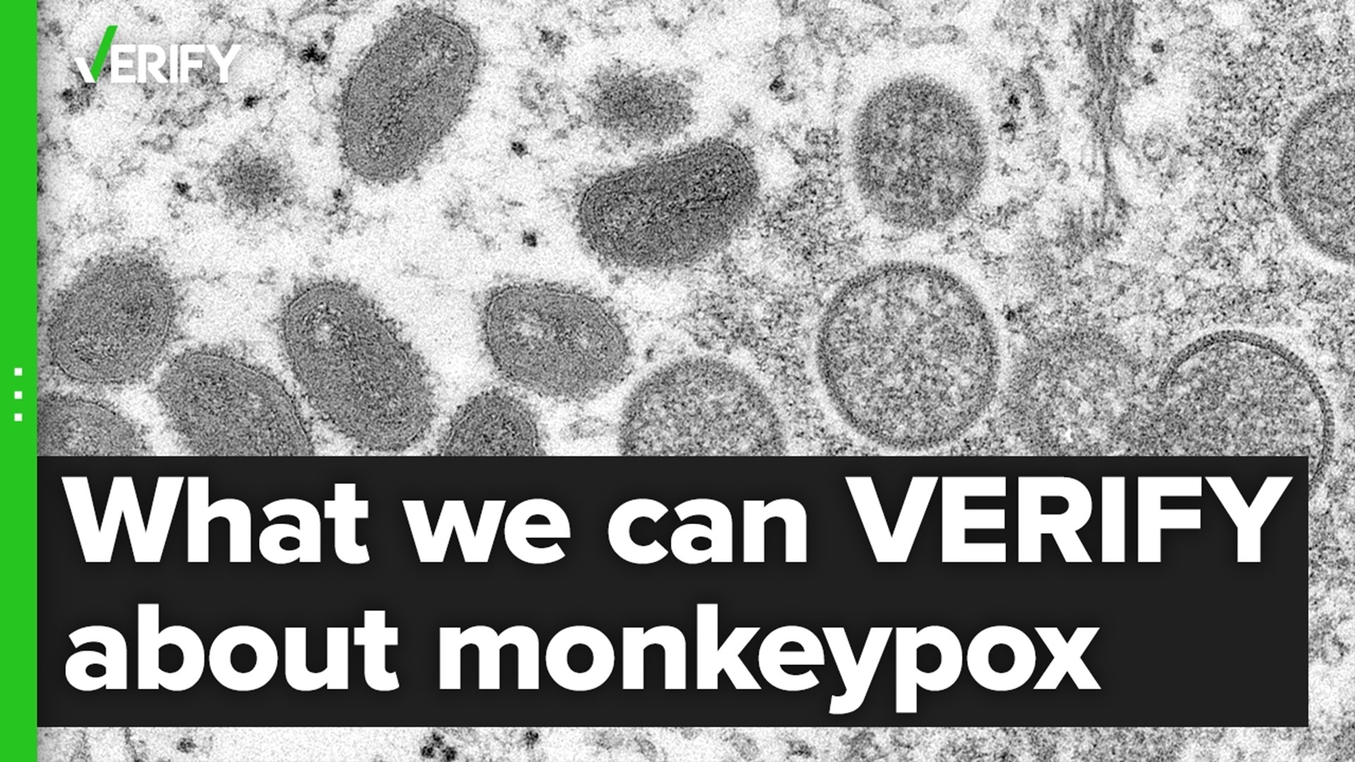 The VERIFY team looked into common questions regarding monkeypox.