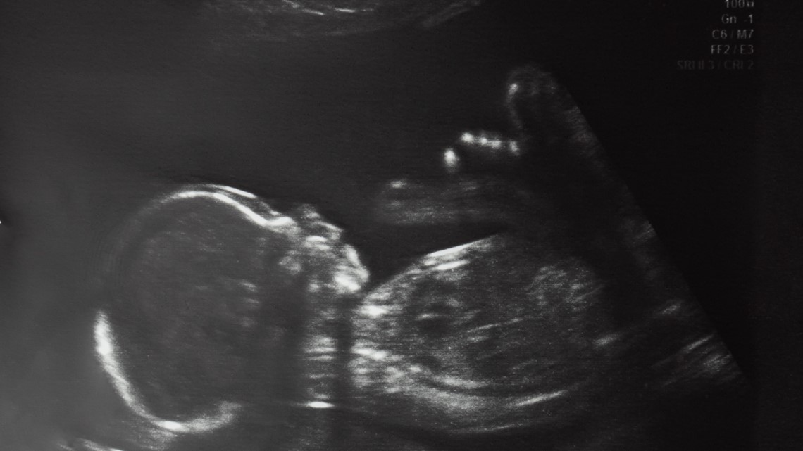 Texas fertility clinic sued for fertilizing eggs with wrong sperm - Vimarsana News