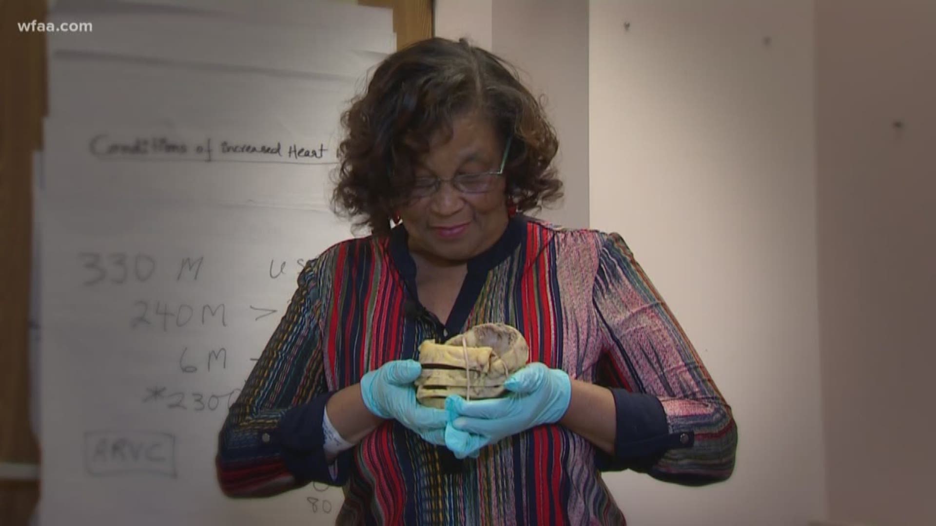 She battled heart disease for years. Now that she's recovering from a heart transplant, she got to hold her old heart.