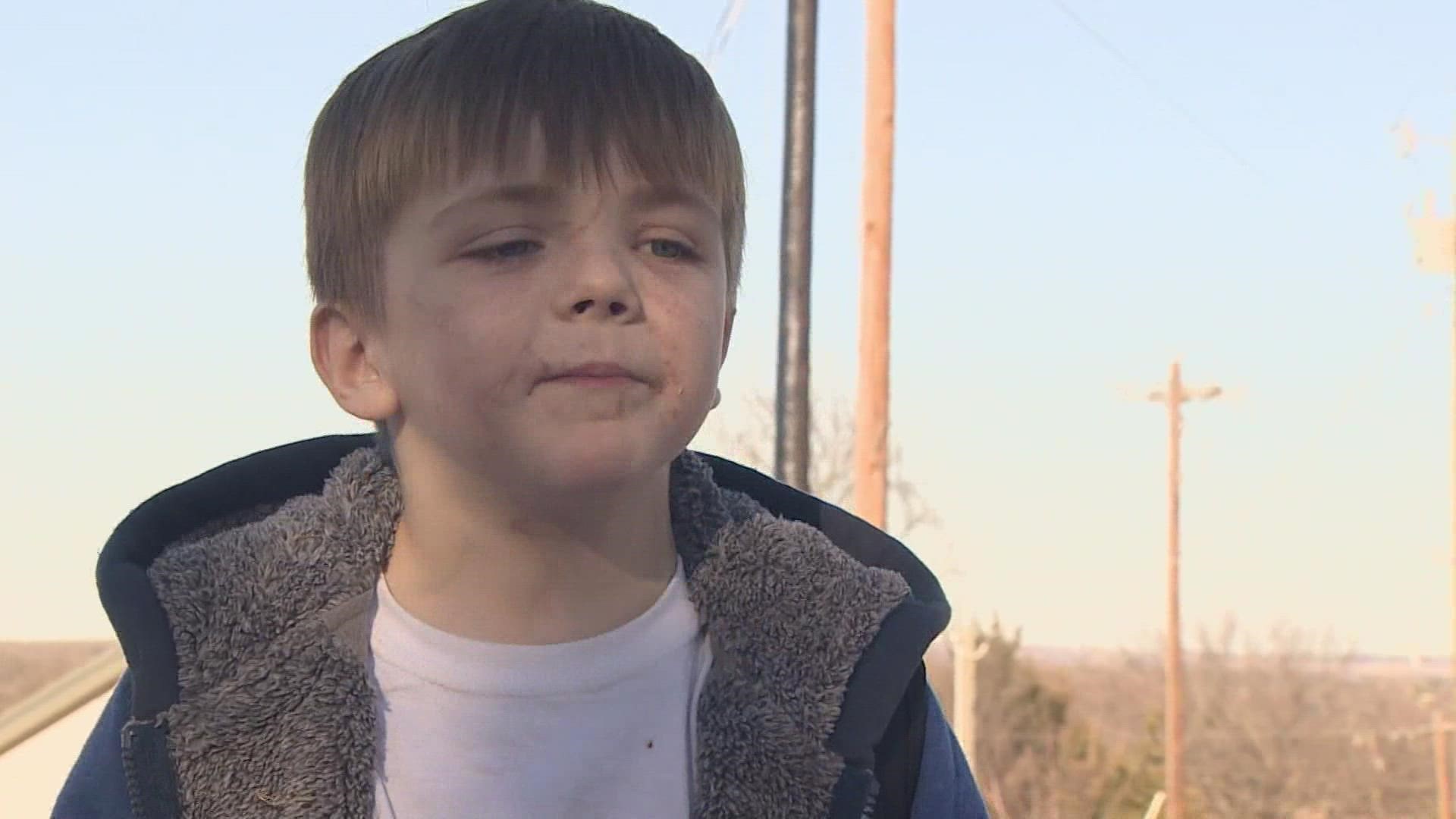 A Reno, Texas boy is recovering after being attacked by his neighbor's dog.