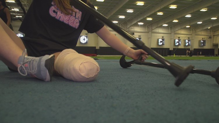 This North Texas cheer star lost her leg -- and didn't let that stop her from continuing her passion