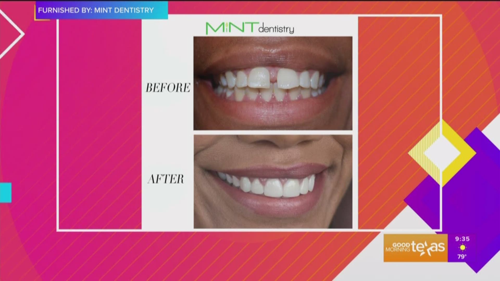 Call (214) 821-MINT or (214) 821-6468 for more information or go to www.mintdentistry.com.