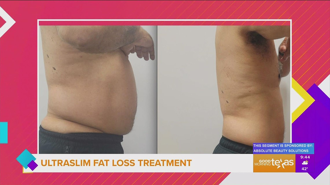 How Ultraslim technology works