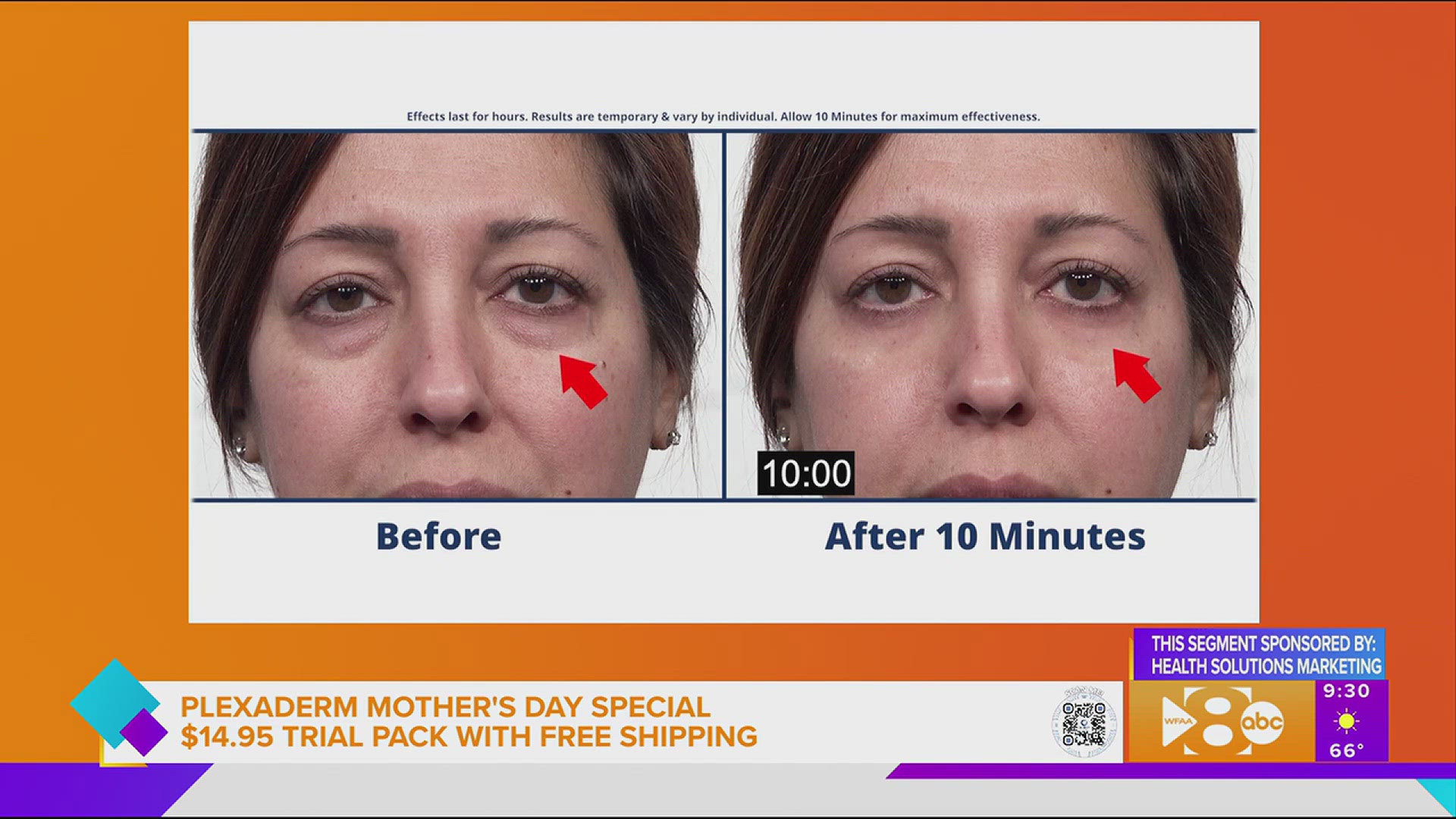 See how Plexaderm can help you look picture perfect. This segment is sponsored by Health Solutions Marketing. Call 800.660.4091 or go to plexadermtrial.com for more.