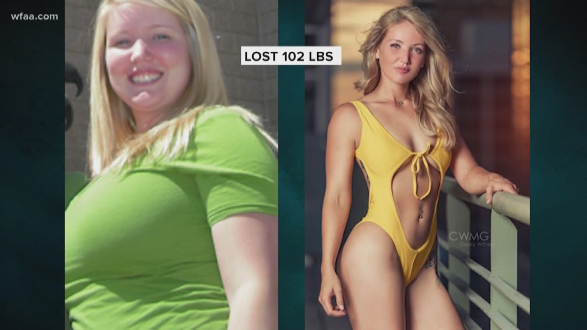 Transformation Tuesday This Woman Gained 100 Pounds After An Accident Then Lost It All