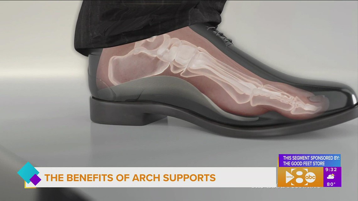The benefits of arch supports