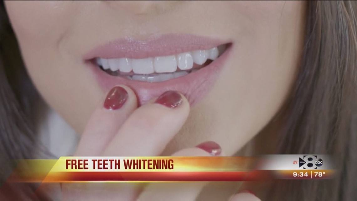 Free Teeth Whitening At Mint Dentistry Wfaa Com