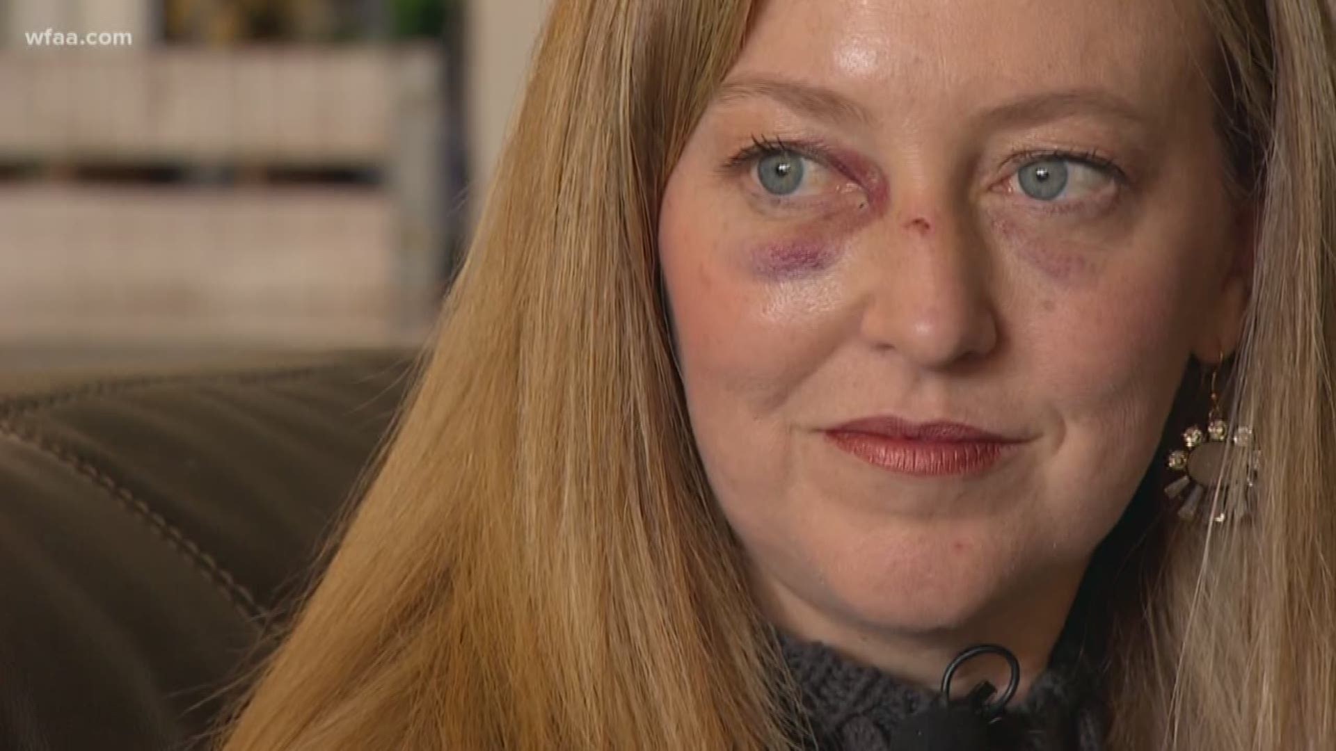 The man punched her in the face in the middle of the afternoon, breaking her nose.