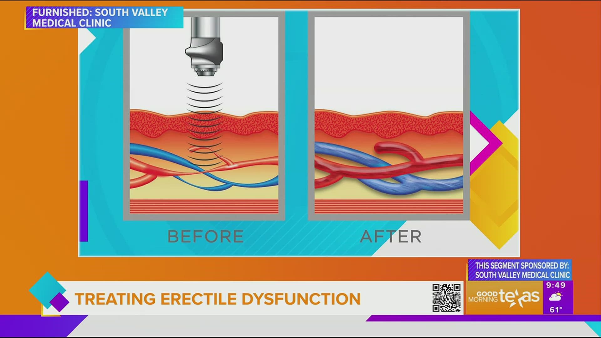 Treating Erectile Dysfunction at South Valley Medical Clinic