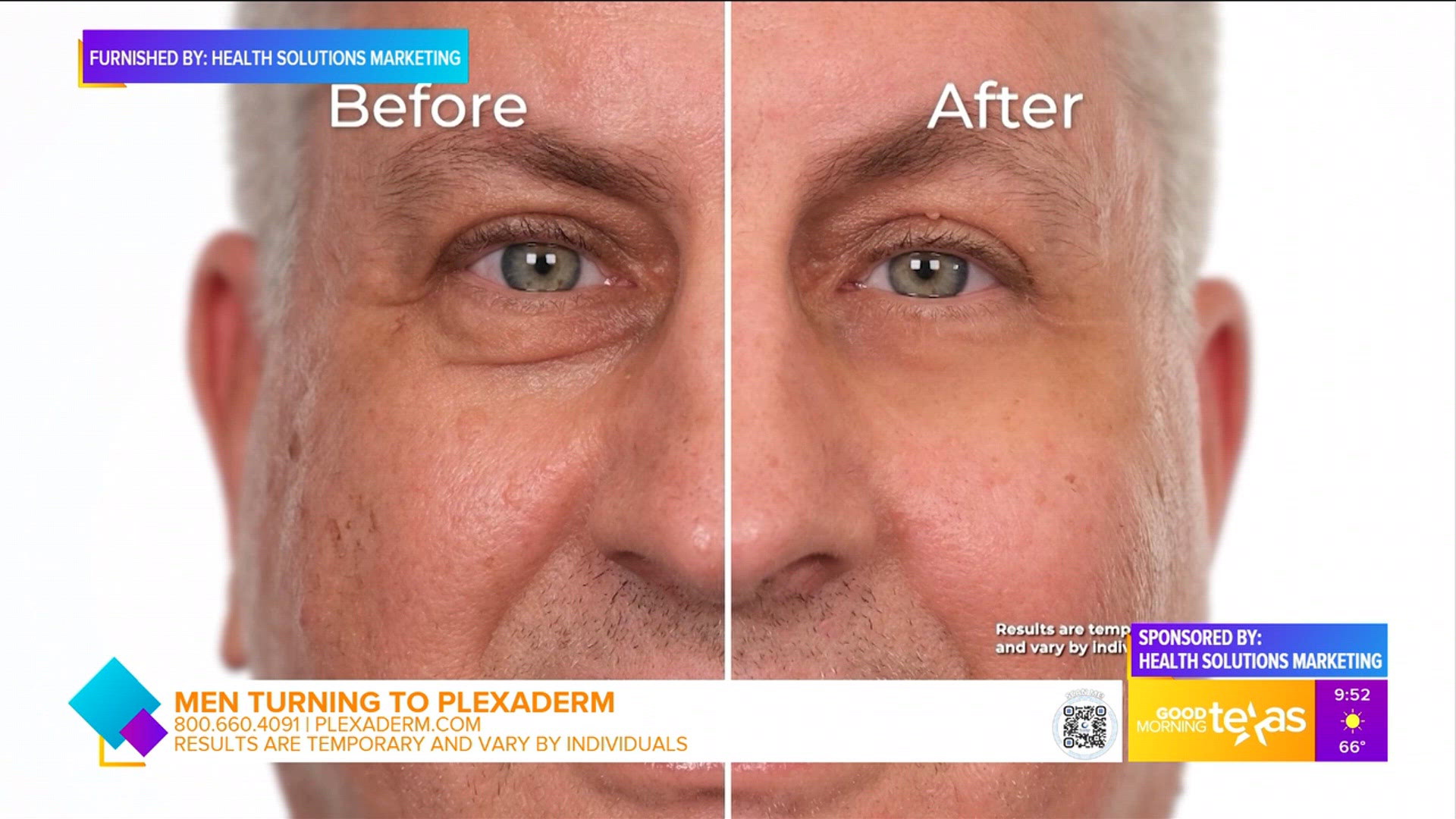 Plexaderm Lifestyle Consultant Scott DeFalco shares why men are turning to Plexaderm.