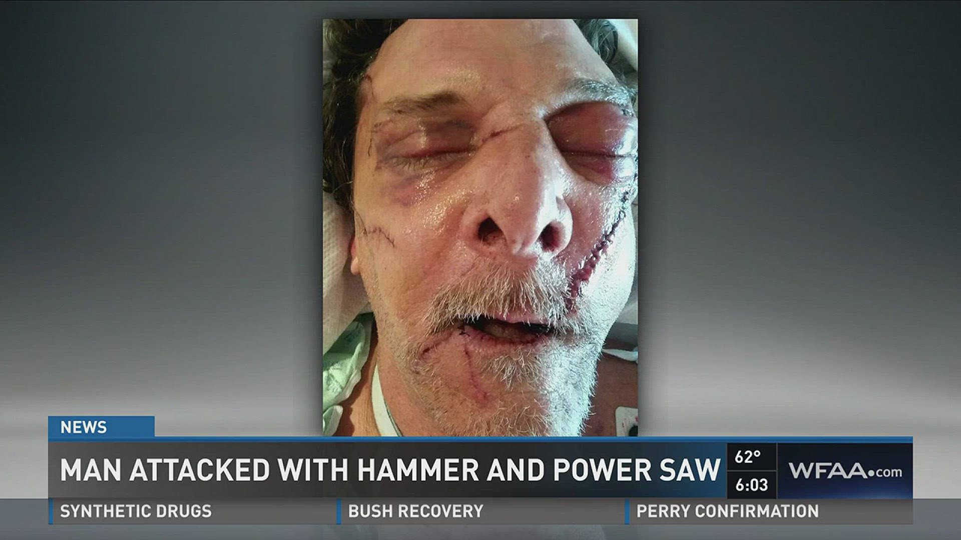 MAN ATTACKED WITH HAMMER AND POWER SAW