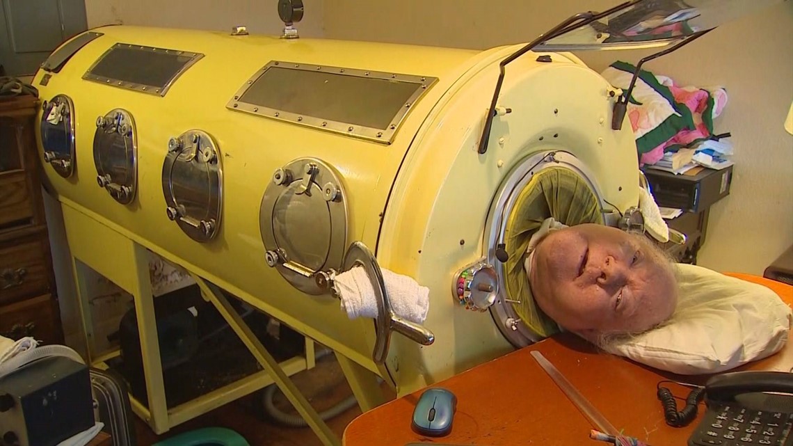 Man who lived in iron lung, Paul Alexander, dies at 78