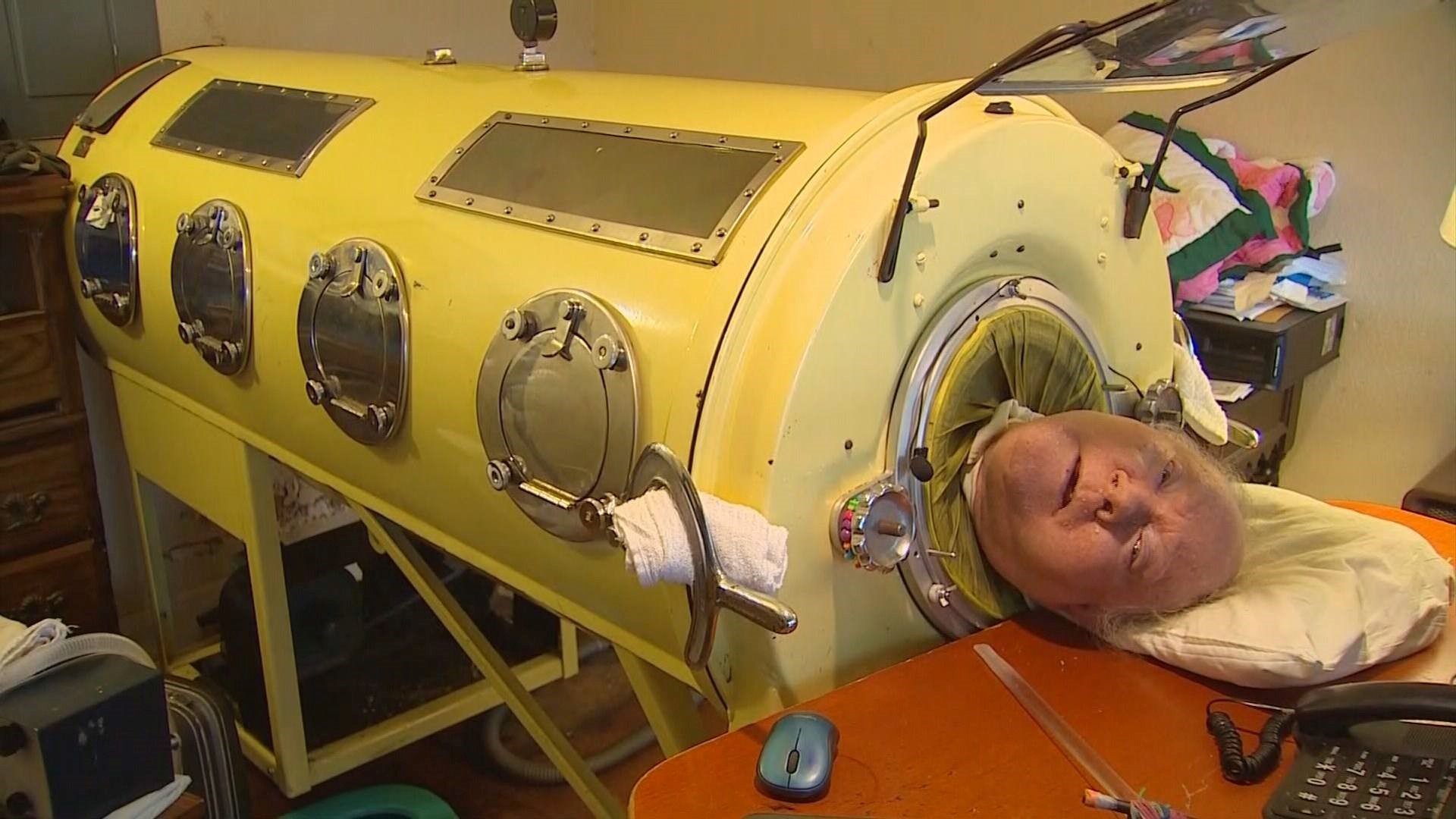 Iron Lung Disease