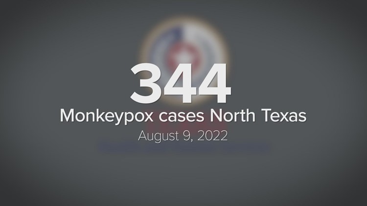More than 340 monkeypox cases reported in North Texas