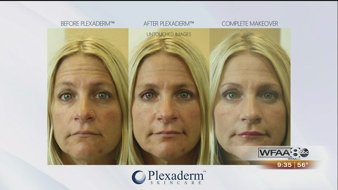 The Power Of Plexaderm See How To Erase Under Eye Bags In Minutes Wfaa Com