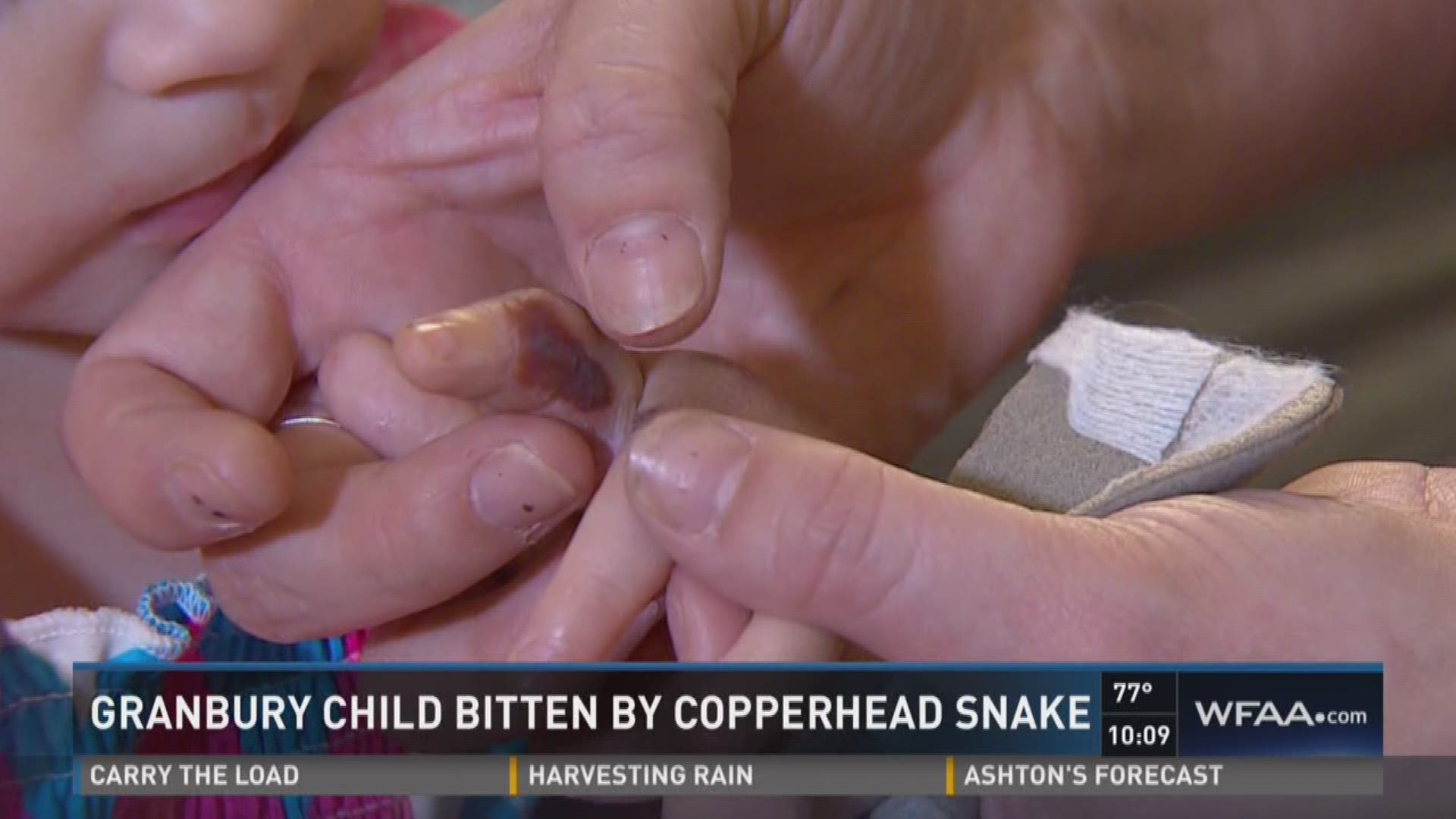 Granbury child bitten by copperhead snake
