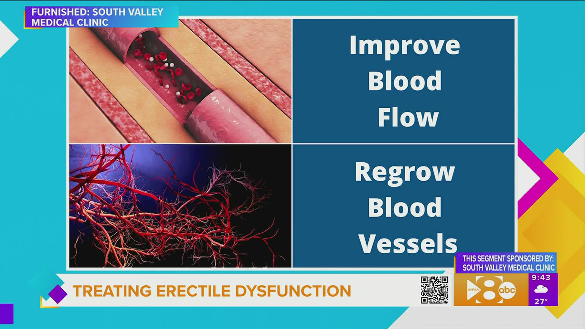 A non-invasive treatment for erectile dysfunction - wfaa.com