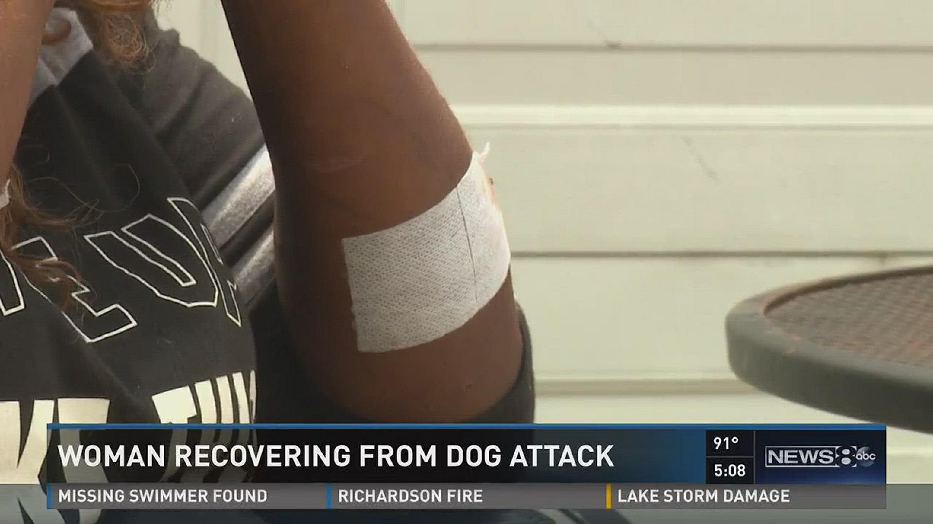 Oak Cliff woman recovering after vicious dog attack | wfaa.com