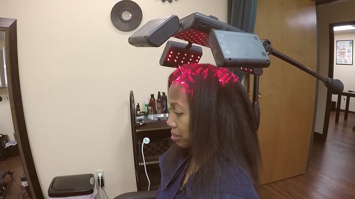 A holistic approach to hair loss treatment | wfaa.com