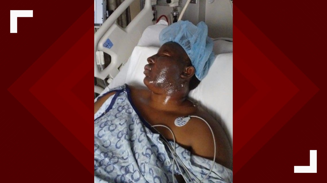 Eight burn victims sue over exploding cans of Pam cooking spray