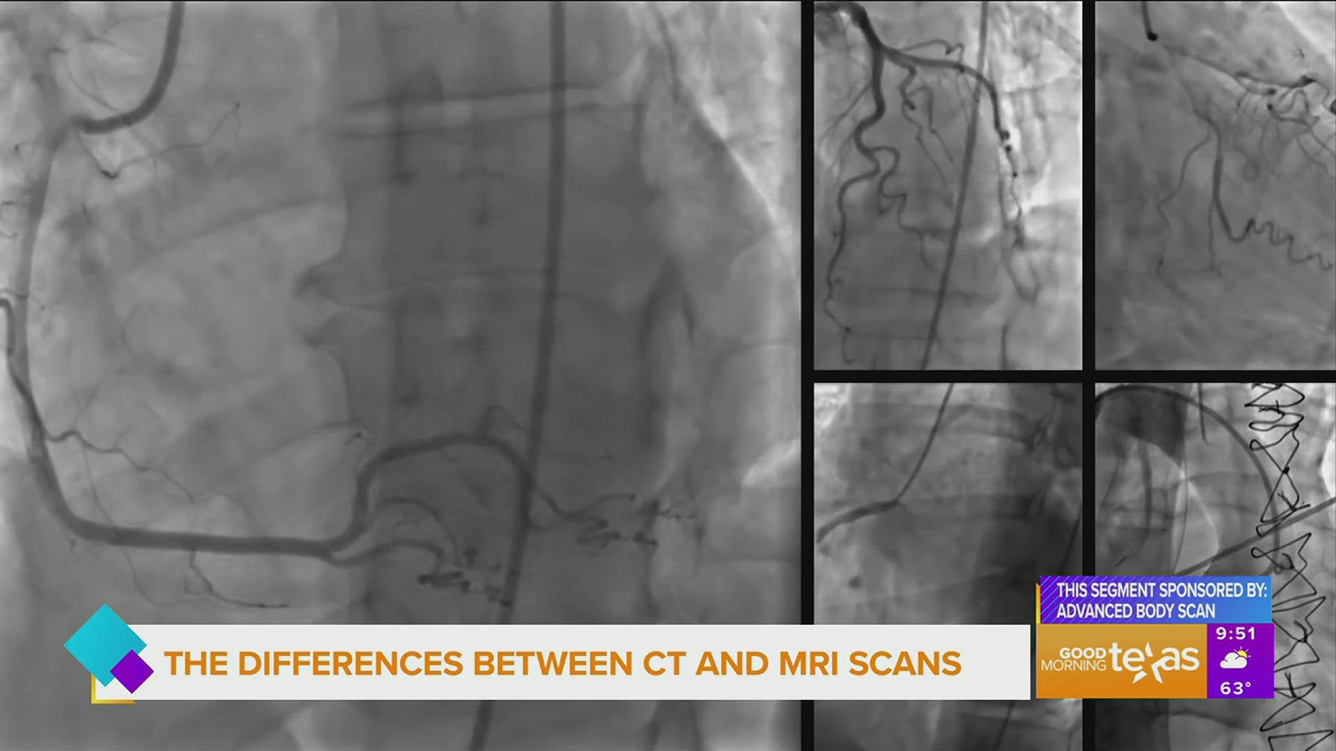 Advanced Body Scan offers technology to detect a disease before