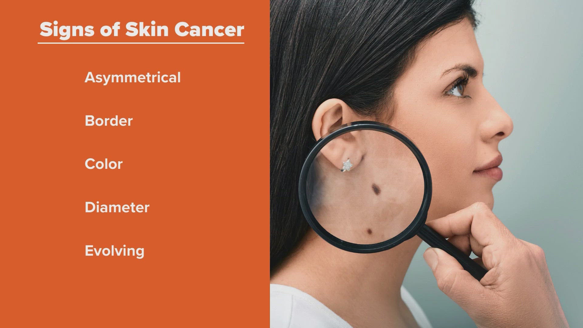 Medical professionals urge people to routinely check for signs of skin cancer and get any suspicious spots evaluated.