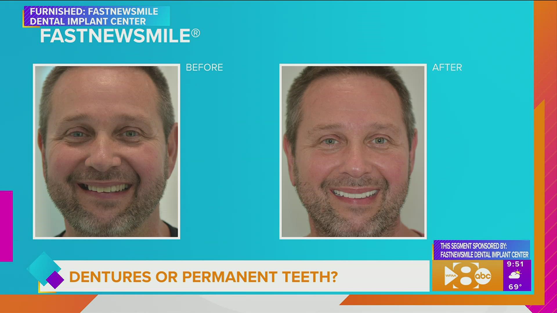 This segment is sponsored by: FastNewSmile® Dental Implant Center