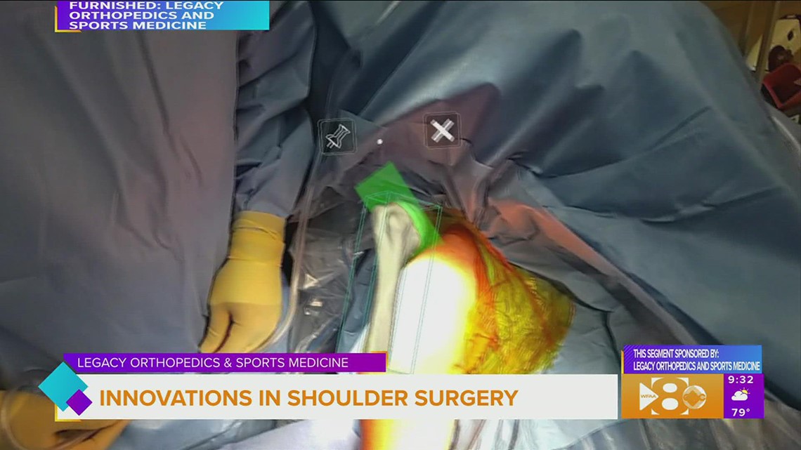 Innovations in Shoulder Surgery
