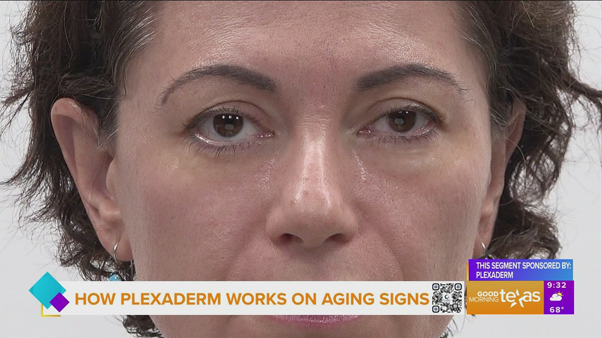 This segment is sponsored by: Plexaderm