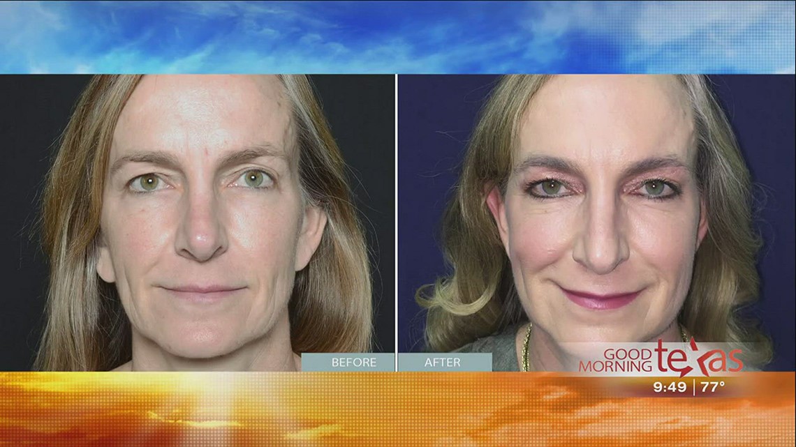 Finally a solution for sagging skin on the face and body | wfaa.com