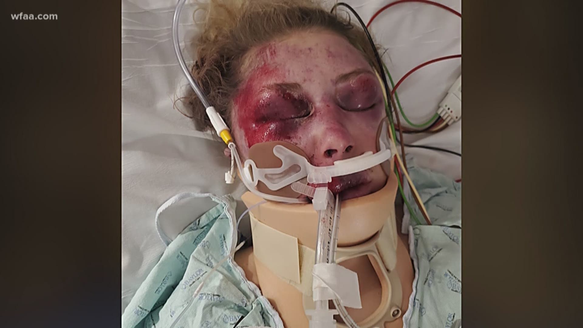 Jonna King, 27, was beaten with a fire extinguisher and carjacked by a total stranger following a shift at the Dallas hotel.