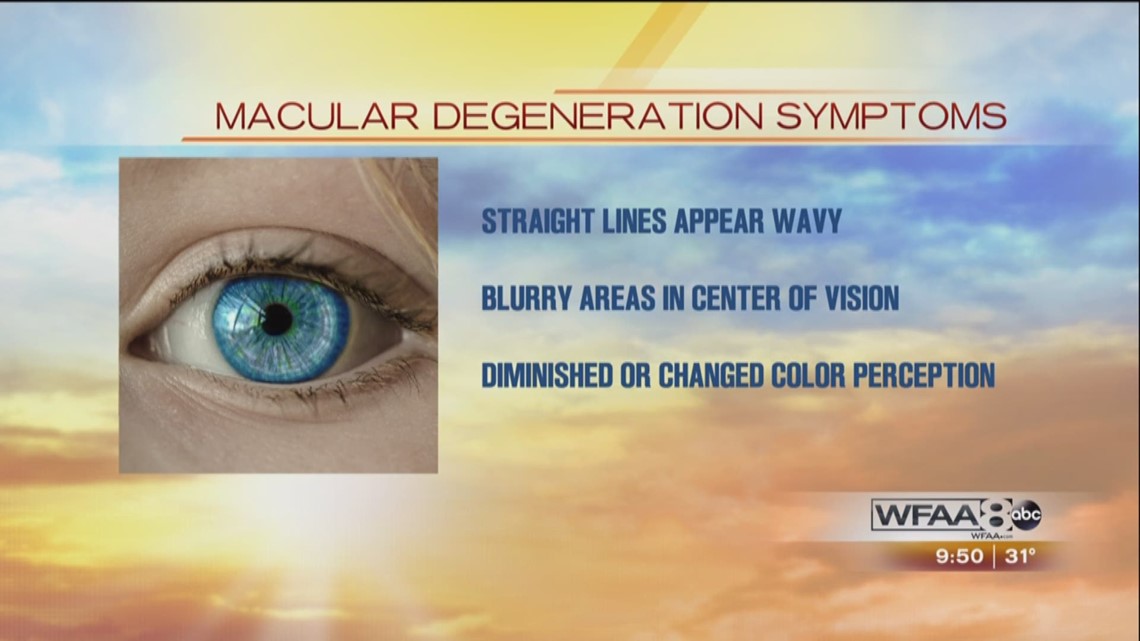 What you need to know about macular degeneration
