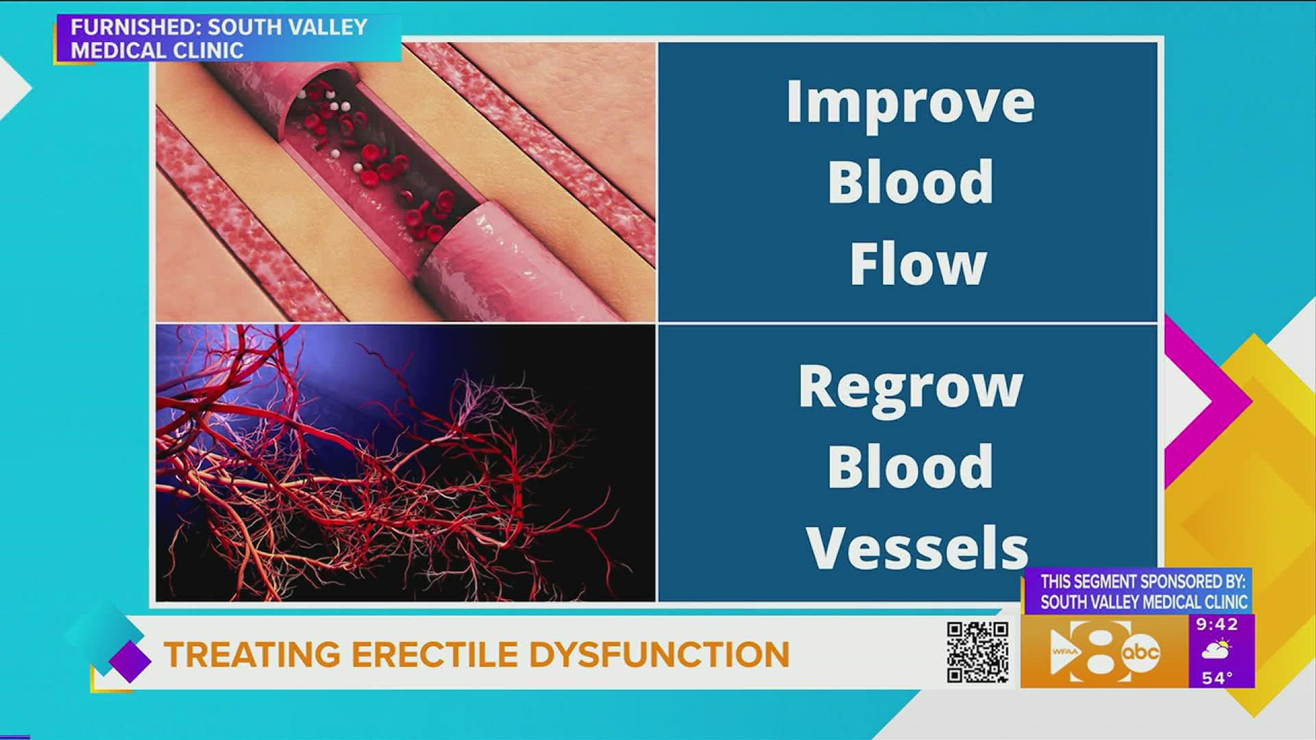 A non invasive approach to treating erectile dysfunction