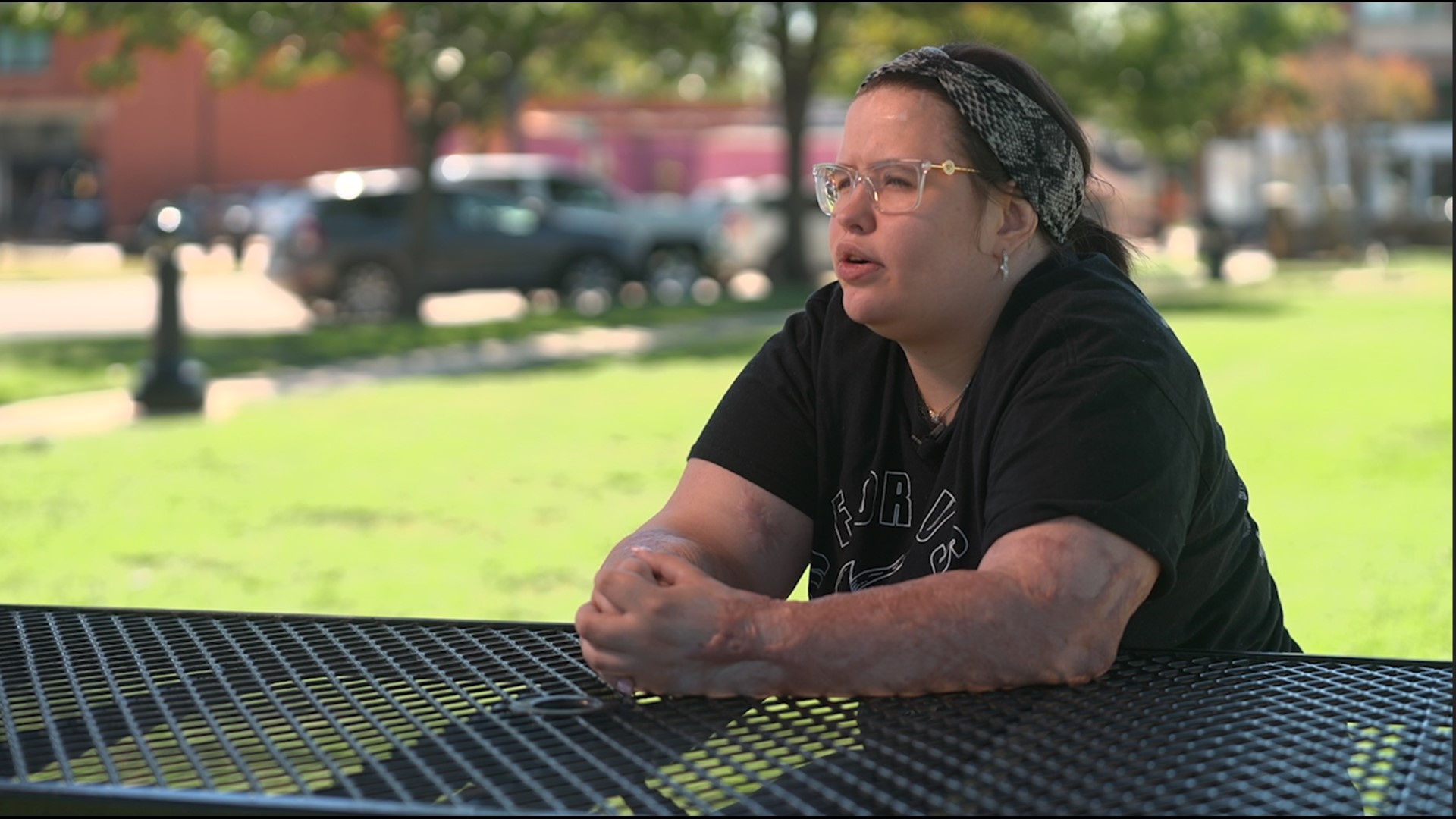 With scars, Simone Valdez-Junkin is constantly reminded about how she survived sadistic torture by 37-year-old Alicia Calderon.