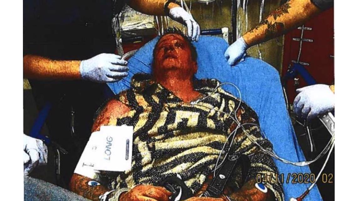 Lawsuit: Texas man hit by officers with flashlight 16 times - Vimarsana News