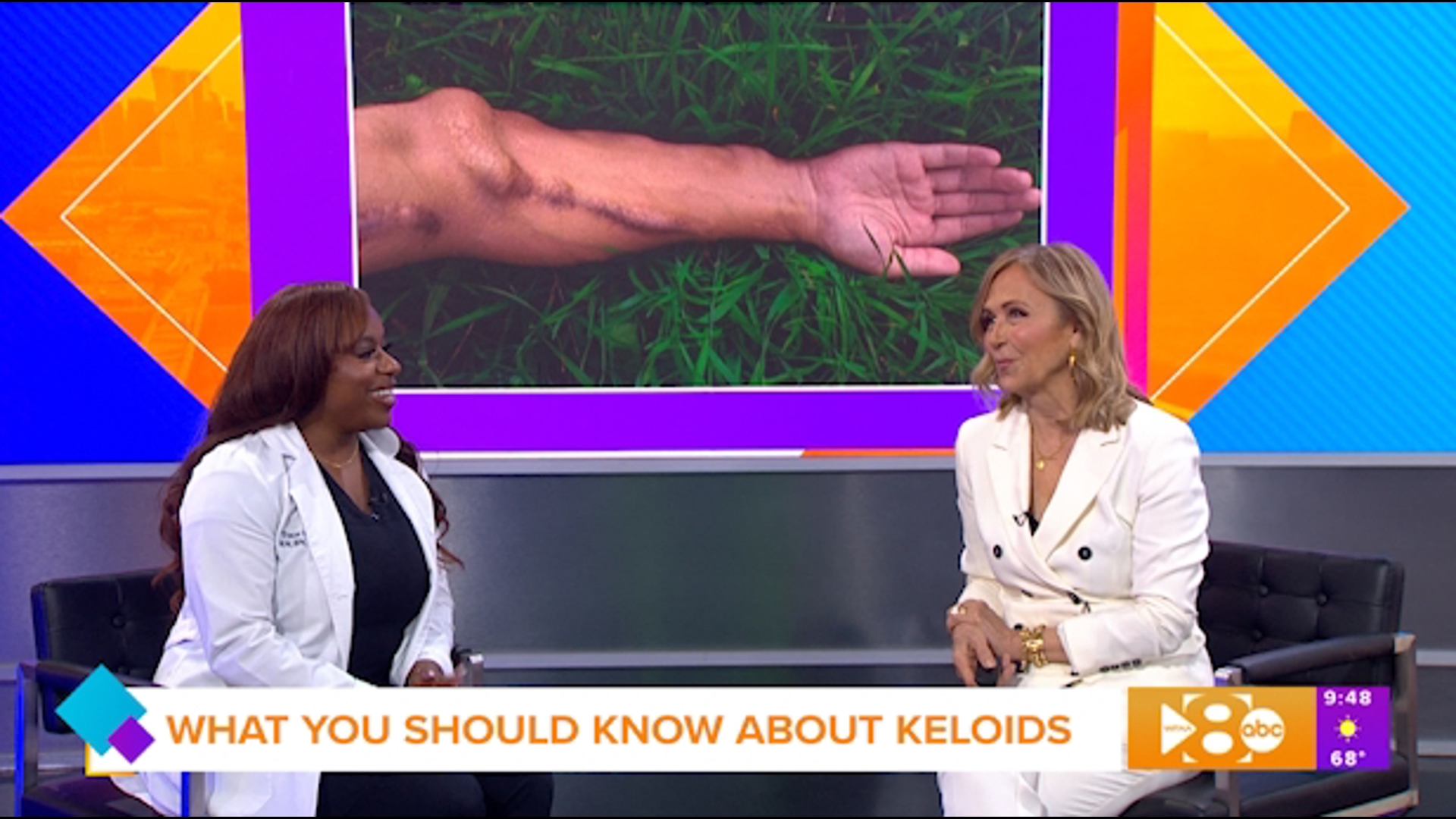 KELOIDS