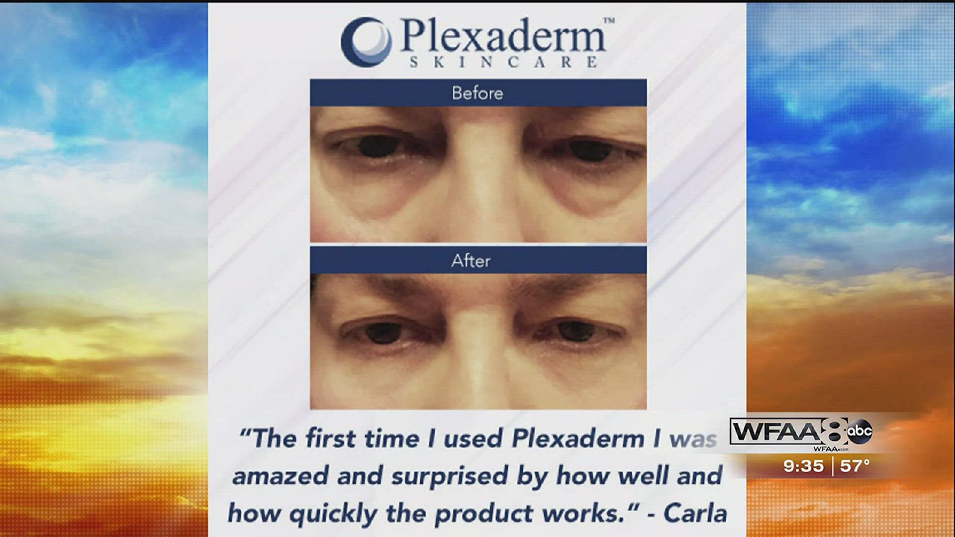 Call (800) 660-5516 for more information or go to www.pleaxderm.com.