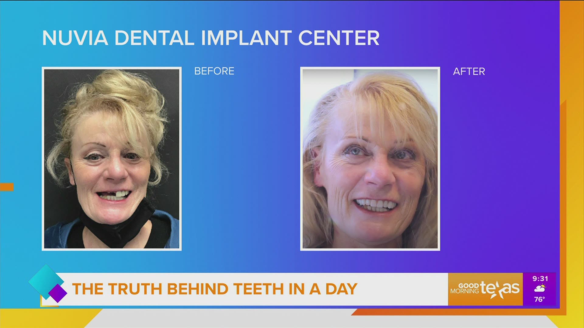 This segment is sponsored by: Nuvia Dental Implant Center