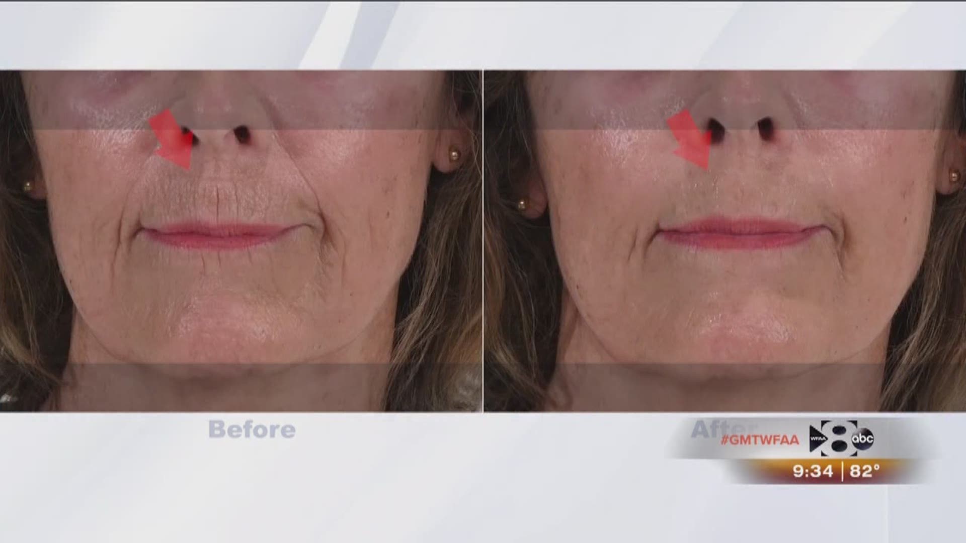 A Gift of Looking Younger with Plexaderm . Head to Plexaderm for more information. 