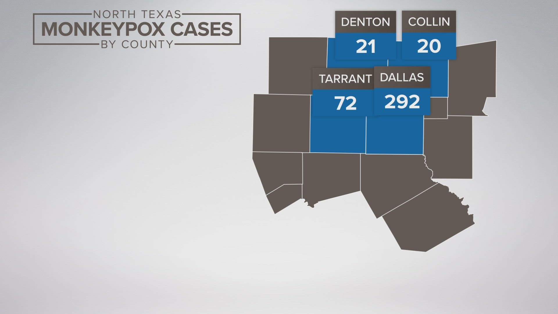 Dallas County has the most monkeypox cases at 292.