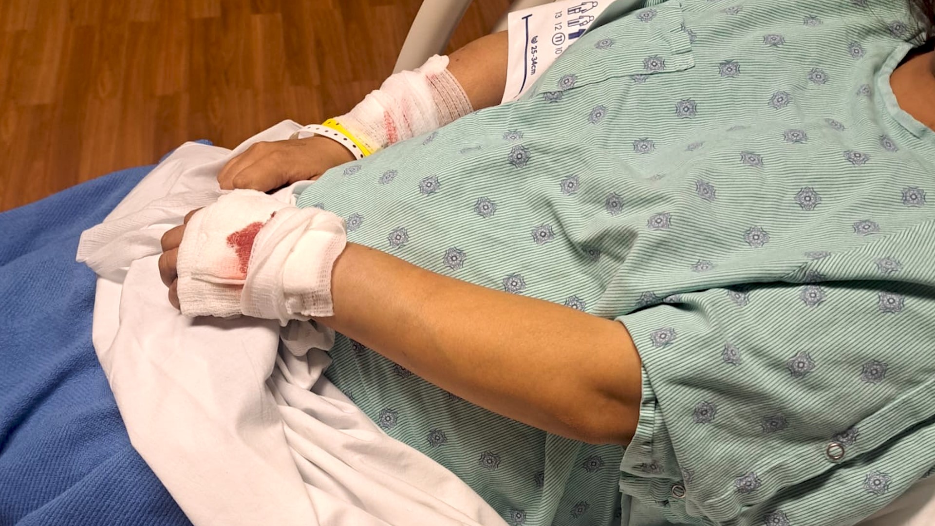 Reyna Gutierrez spent 24 hours in the hospital to monitor her baby and treatment for the bites on her hands and arms.