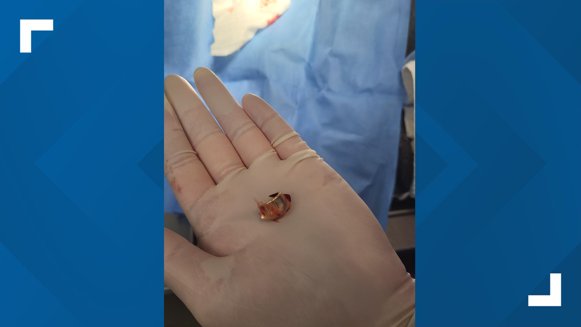 Dog recovering after being shot in the face and left to suffer in North ...