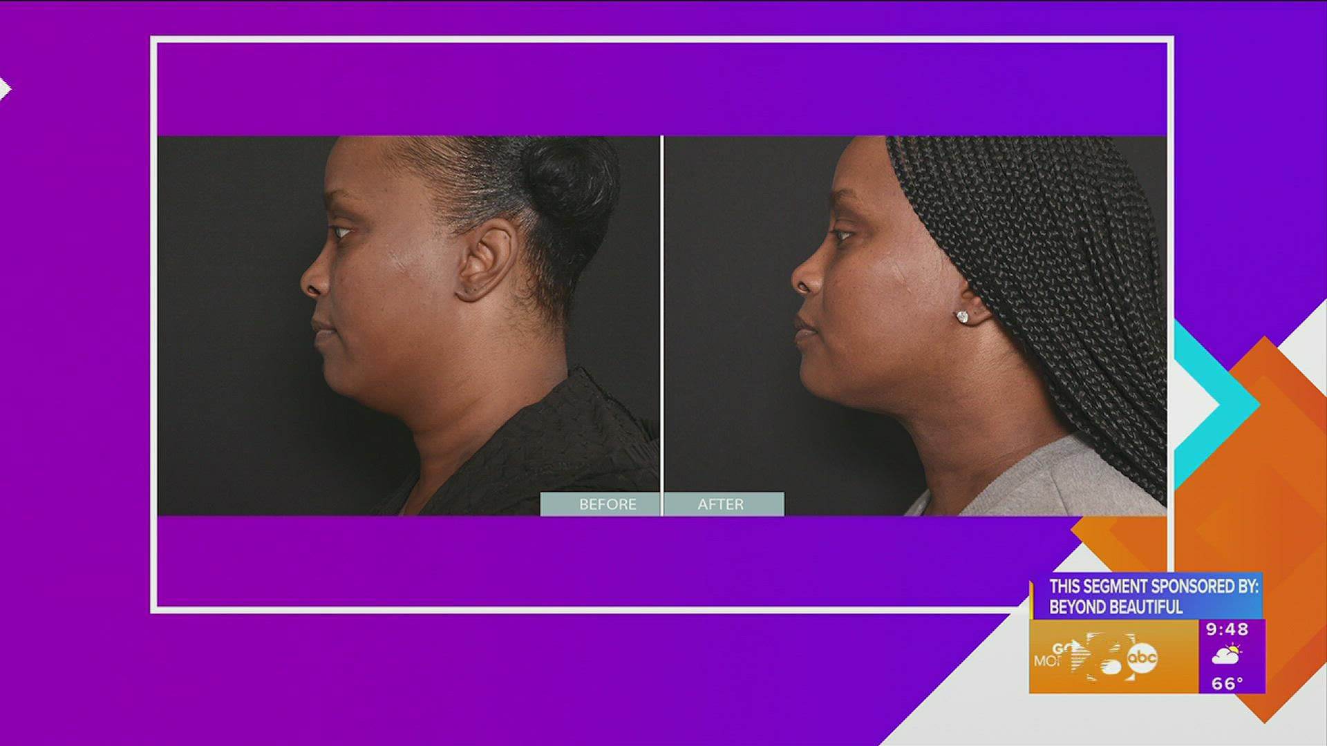 Keep your skin tight and toned with Beyond Beautiful