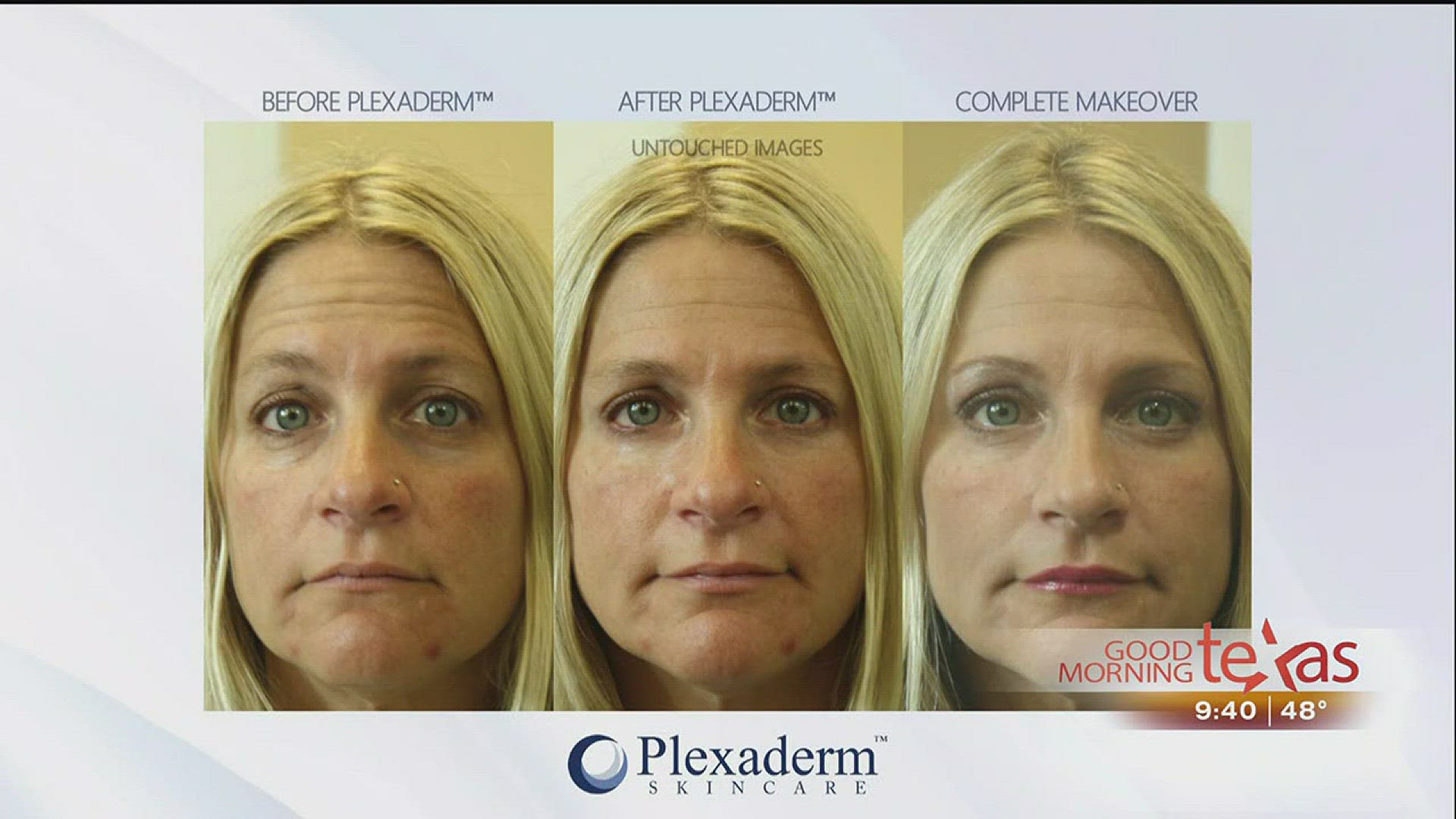 Call (800) 660-4091 for more information or go to www.plexaderm.com.