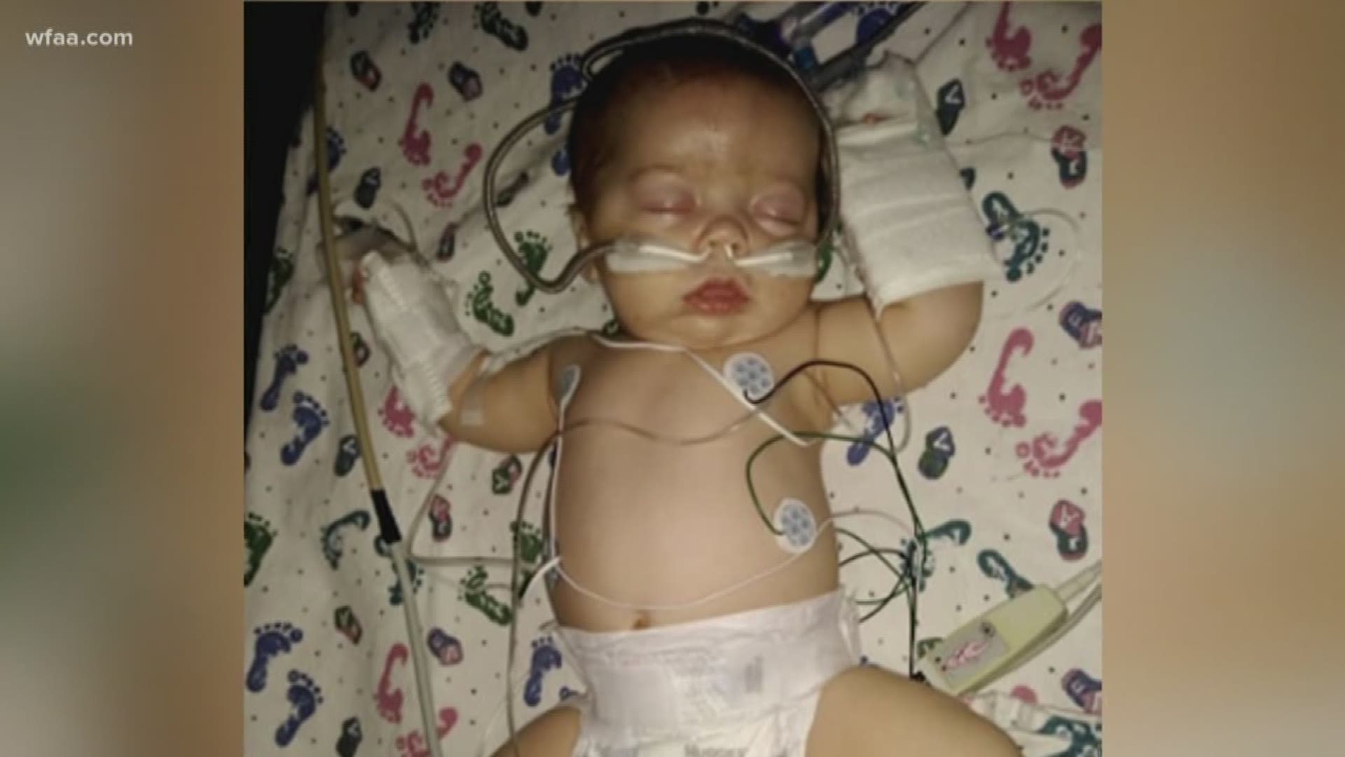 Baby Jax is still in the hospital, fighting to survive, his great-aunt says.